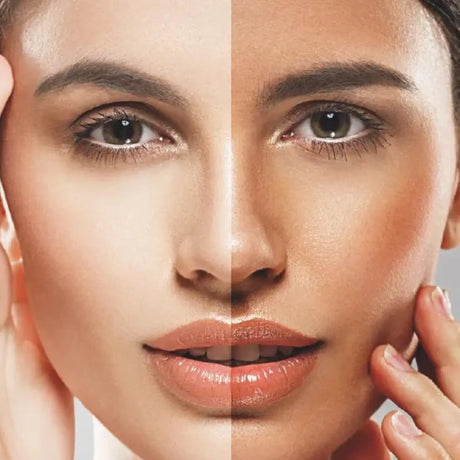 Närbild på kvinna som visas före-efter. Kvinnans hudton är tydligt brunare på höger halva.